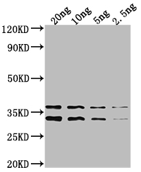 Western Blot Positive WB detected in Recombinant protein All lanes: NARL antibody at 1:2000 Secondary Goat polyclonal to rabbit IgG at 1/50000 dilution Predicted band size: 35.5 kDa Observed band size: 34 kDa Western Blot Positive WB detected in Recombinant protein All lanes: NARL antibody at 1:2000 Secondary Goat polyclonal to rabbit IgG at 1/50000 dilution Predicted band size: 35.5 kDa Observed band size: 34 kDa
