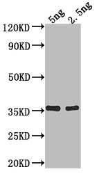 Western Blot Positive WB detected in Recombinant protein All lanes: fimA antibody at 1:2000 Secondary Goat polyclonal to rabbit IgG at 1/50000 dilution Predicted band size: 31.8 kDa Observed band size: 36 kDa Western Blot Positive WB detected in Recombinant protein All lanes: fimA antibody at 1:2000 Secondary Goat polyclonal to rabbit IgG at 1/50000 dilution Predicted band size: 31.8 kDa Observed band size: 36 kDa