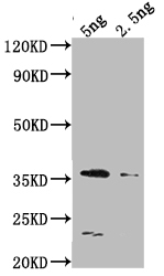 Western Blot Positive WB detected in Recombinant protein All lanes: DCM antibody at 1:2000 Secondary Goat polyclonal to rabbit IgG at 1/50000 dilution Predicted band size: 36.5 kDa Observed band size: 34 kDa Western Blot Positive WB detected in Recombinant protein All lanes: DCM antibody at 1:2000 Secondary Goat polyclonal to rabbit IgG at 1/50000 dilution Predicted band size: 36.5 kDa Observed band size: 34 kDa