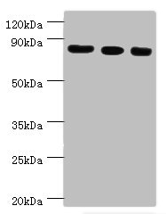 Western blot All lanes: Histone-lysine N-methyltransferase EZH2 antibody at 12ug/ml Lane 1: A431 whole cell lysate Lane 2: Jurkat whole cell lysate Lane 3: Mouse kidney tissue Secondary Goat polyclonal to rabbit IgG at 1/10000 dilution Predicted band size: 86, 87, 82, 85, 80 kDa Observed band size: 86 kDa Western blot All lanes: Histone-lysine N-methyltransferase EZH2 antibody at 12ug/ml Lane 1: A431 whole cell lysate Lane 2: Jurkat whole cell lysate Lane 3: Mouse kidney tissue Secondary Goat polyclonal to rabbit IgG at 1/10000 dilution Predicted band size: 86, 87, 82, 85, 80 kDa Observed band size: 86 kDa
