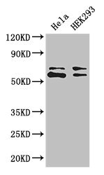 CSB-PA618754LA01HU
