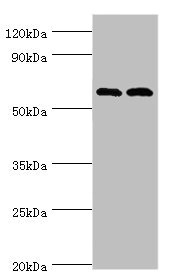 Western blot All lanes: Serine/threonine-protein kinase PAK 2 antibody at 2ug/ml Lane 1: Jurkat whole cell lysate Lane 2: Hela whole cell lysate Secondary Goat polyclonal to rabbit IgG at 1/10000 dilution Predicted band size: 58 kDa Observed band size: 58 kDa Western blot All lanes: Serine/threonine-protein kinase PAK 2 antibody at 2ug/ml Lane 1: Jurkat whole cell lysate Lane 2: Hela whole cell lysate Secondary Goat polyclonal to rabbit IgG at 1/10000 dilution Predicted band size: 58 kDa Observed band size: 58 kDa