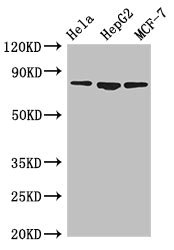 Western Blot Positive WB detected in: Hela whole cell lysate, HepG2 whole cell lysate, MCF-7 whole cell lysate All lanes: IMMT antibody at 3.5ug/ml Secondary Goat polyclonal to rabbit IgG at 1/50000 dilution Predicted band size: 84, 83, 81 kDa Observed band size: 84 kDa