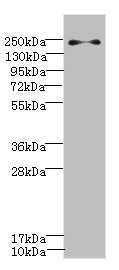 Western blot All lanes: PLA2R1 antibody IgG at 0.78ug/ml + Jurkat whole cell lysate Secondary Goat polyclonal to rabbit IgG at 1/10000 dilution Predicted band size: 169, 153 kDa Observed band size: 169 kDa