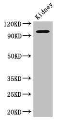 Western Blot Positive WB detected in: Mouse kidney tissue All lanes: AAK1 antibody at 2.5ug/ml Secondary Goat polyclonal to rabbit IgG at 1/50000 dilution Predicted band size: 104, 94 kDa Observed band size: 104 kDa