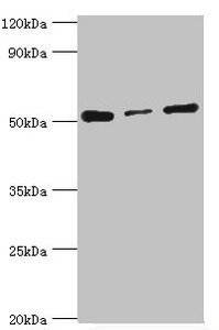 Western blot All lanes: Programmed cell death protein 4 antibody at 4ug/ml Lane 1: Hela whole cell lysate Lane 2: MCF-7 whole cell lysate Lane 3: Jurkat whole cell lysate Secondary Goat polyclonal to rabbit IgG at 1/10000 dilution Predicted band size: 52, 51 kDa Observed band size: 52 kDa
