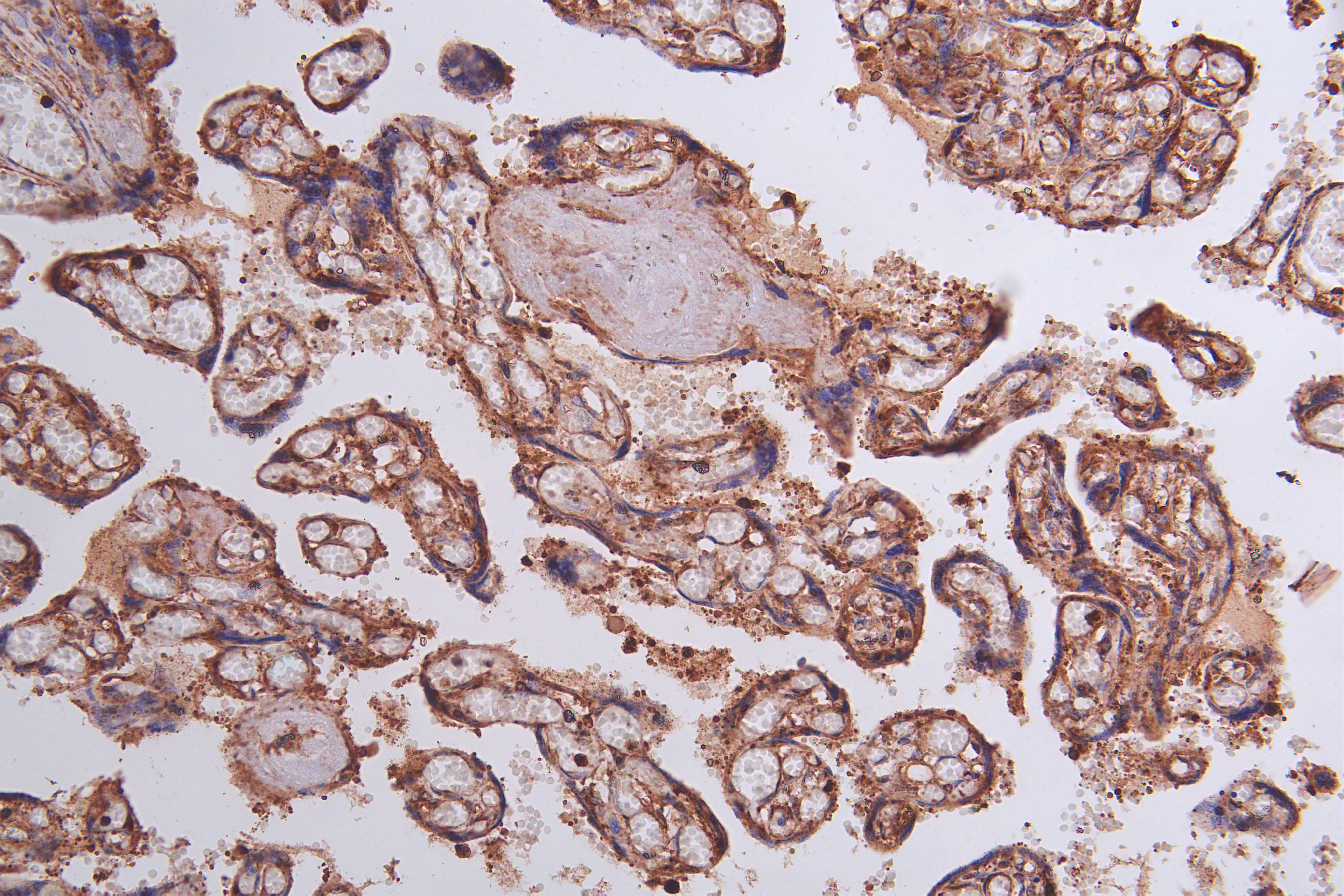 Immunohistochemistry of paraffin-embedded human Pancreatic tissue using CSB-PA704858ESR1HU at dilution of 1:50