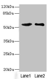 CSB-PA733704ESR1HU