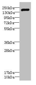 Western blot All lanes: VARS antibody IgG at 2.29ug/ml + Hela whole cell lysate Secondary Goat polyclonal to rabbit IgG at 1/10000 dilution Predicted band size: 141, 34 kDa Observed band size: 141 kDa