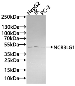 Western blot All lanes: B7H6 antibody at 2 ug/ml Lane 1: Mouse heart tissue Lane 2: Mouse liver tissue Lane 3: Mouse brain tissue Lane 4: Hela whole cell lysate Secondary Goat polyclonal to rabbit IgG at 1/10000 dilution Predicted band size: 51 kDa Observed band size: 51, 38, 32 kDa Western blot All lanes: B7H6 antibody at 2 ug/ml Lane 1: Mouse heart tissue Lane 2: Mouse liver tissue Lane 3: Mouse brain tissue Lane 4: Hela whole cell lysate Secondary Goat polyclonal to rabbit IgG at 1/10000 dilution Predicted band size: 51 kDa Observed band size: 51, 38, 32 kDa