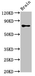 Western Blot Positive WB detected in: Rat brain tissue All lanes: CASC1 antibody at 3.4ug/ml Secondary Goat polyclonal to rabbit IgG at 1/50000 dilution Predicted band size: 84, 79, 82, 76 kDa Observed band size: 84 kDa