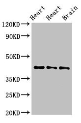 Western Blot Positive WB detected in: Rat heart tissue, Mouse heart tissue, Mouse brain tissue All lanes: NPSR1 antibody at 4ug/ml Secondary Goat polyclonal to rabbit IgG at 1/50000 dilution Predicted band size: 43, 36, 45, 44, 42, 19, 16, 17, 11 kDa Observed band size: 43 kDa Western Blot Positive WB detected in: Rat heart tissue, Mouse heart tissue, Mouse brain tissue All lanes: NPSR1 antibody at 4ug/ml Secondary Goat polyclonal to rabbit IgG at 1/50000 dilution Predicted band size: 43, 36, 45, 44, 42, 19, 16, 17, 11 kDa Observed band size: 43 kDa