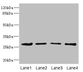 Western blot All lanes: DCXR antibody at 2.93ug/ml Lane 1: Mouse gonadal tissue Lane 2: HepG2 whole cell lysate Lane 3: A431 whole cell lysate Lane 4: MCF-7 whole cell lysate Secondary Goat polyclonal to rabbit IgG at 1/10000 dilution Predicted band size: 26 kDa Observed band size: 26 kDa Western blot All lanes: DCXR antibody at 2.93ug/ml Lane 1: Mouse gonadal tissue Lane 2: HepG2 whole cell lysate Lane 3: A431 whole cell lysate Lane 4: MCF-7 whole cell lysate Secondary Goat polyclonal to rabbit IgG at 1/10000 dilution Predicted band size: 26 kDa Observed band size: 26 kDa