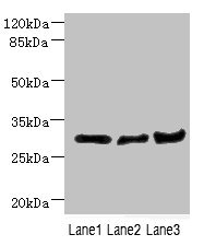 Western blot All lanes: DCXR antibody at 2.23ug/ml Lane 1: Mouse lung tissue Lane 2: Mouse liver tissue Lane 3: Mouse gonadal tissue Secondary Goat polyclonal to rabbit IgG at 1/10000 dilution Predicted band size: 26 kDa Observed band size: 26 kDa Western blot All lanes: DCXR antibody at 2.23ug/ml Lane 1: Mouse lung tissue Lane 2: Mouse liver tissue Lane 3: Mouse gonadal tissue Secondary Goat polyclonal to rabbit IgG at 1/10000 dilution Predicted band size: 26 kDa Observed band size: 26 kDa