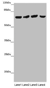 Western blot All lanes: FRMD5 antibody at 16 ug/ml Lane 1: Mouse kidney tissue Lane 2: Mouse heart tissue Lane 3: Mouse skeletal muscle tissue Lane 4: Mouse lung tissue Secondary Goat polyclonal to rabbit IgG at 1/10000 dilution Predicted band size: 66, 64 kDa Observed band size: 65 kDa Western blot All lanes: FRMD5 antibody at 16 ug/ml Lane 1: Mouse kidney tissue Lane 2: Mouse heart tissue Lane 3: Mouse skeletal muscle tissue Lane 4: Mouse lung tissue Secondary Goat polyclonal to rabbit IgG at 1/10000 dilution Predicted band size: 66, 64 kDa Observed band size: 65 kDa
