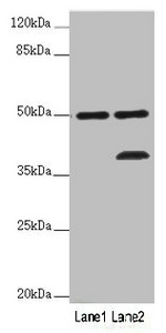 Western blot All lanes: PLIN5 antibody at 2 ug/ml Lane 1: Mouse kidney tissue Lane 2: Mouse brain tissue Secondary Goat polyclonal to rabbit IgG at 1/10000 dilution Predicted band size: 51 kDa Observed band size: 51, 36 kDa
