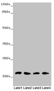 Western blot All lanes: MSRB3 antibody at 4.61 ug/ml Lane 1: Mouse large intestine tissue Lane 2: Mouse lung tissue Lane 3: Mouse gonadal tissue Lane 4: Mouse heart tissue Secondary Goat polyclonal to rabbit IgG at 1/10000 dilution Predicted band size: 21 kDa Observed band size: 21 kDa Western blot All lanes: MSRB3 antibody at 4.61 ug/ml Lane 1: Mouse large intestine tissue Lane 2: Mouse lung tissue Lane 3: Mouse gonadal tissue Lane 4: Mouse heart tissue Secondary Goat polyclonal to rabbit IgG at 1/10000 dilution Predicted band size: 21 kDa Observed band size: 21 kDa