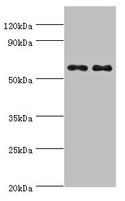 CSB-PA815573ESR2HU WB