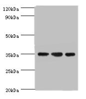 Western blot All lanes: AIMP2 antibody at 5ug/ml Lane 1: Hela whole cell lysate Lane 2: HepG2 whole cell lysate Lane 3: K562 whole cell lysate Secondary Goat polyclonal to rabbit IgG at 1/10000 dilution Predicted band size: 35 kDa Observed band size: 35 kDa Western blot All lanes: AIMP2 antibody at 5ug/ml Lane 1: Hela whole cell lysate Lane 2: HepG2 whole cell lysate Lane 3: K562 whole cell lysate Secondary Goat polyclonal to rabbit IgG at 1/10000 dilution Predicted band size: 35 kDa Observed band size: 35 kDa