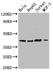 Western Blot Positive WB detected in: Hela whole cell lysate, HepG2 whole cell lysate, Jurkat whole cell lysate, MCF-7 whole cell lysate All lanes: SPPL3 antibody at 3ug/ml Secondary Goat polyclonal to rabbit IgG at 1/50000 dilution Predicted band size: 43, 19 kDa Observed band size: 43 kDa