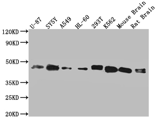 Western Blot Positive WB detected in: Hela whole cell lysate, U87 whole cell lysate, SY5Y whole cell lysate, A549 whole cell lysate, HL-60 whole cell lysate, 293T whole cell lysate, K562 whole cell lysate, mouse brain tissue, rat brain tissue All lanes: SPPL3 antibody at 1:2000 Secondary Goat polyclonal to rabbit IgG at 1/50000 dilution Predicted band size: 43, 19 kDa Observed band size: 43 kDa Western Blot Positive WB detected in: Hela whole cell lysate, U87 whole cell lysate, SY5Y whole cell lysate, A549 whole cell lysate, HL-60 whole cell lysate, 293T whole cell lysate, K562 whole cell lysate, mouse brain tissue, rat brain tissue All lanes: SPPL3 antibody at 1:2000 Secondary Goat polyclonal to rabbit IgG at 1/50000 dilution Predicted band size: 43, 19 kDa Observed band size: 43 kDa