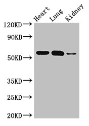 Western Blotting(WB) - SMAD5 Antibody