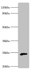 Western blot All lanes: Ubiquinone biosynthesis protein COQ7 homolog antibody at 6ug/ml + Rat heart tissue Secondary Goat polyclonal to rabbit IgG at 1/10000 dilution Predicted band size: 25, 21 kDa Observed band size: 25 kDa