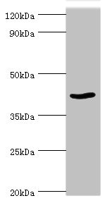 Western blot All lanes: Protein arginine N-methyltransferase 1 antibody at 2ug/ml + NIH/3T3 whole cell lysate Secondary Goat polyclonal to rabbit IgG at 1/10000 dilution Predicted band size: 42, 40, 41 kDa Observed band size: 42 kDa