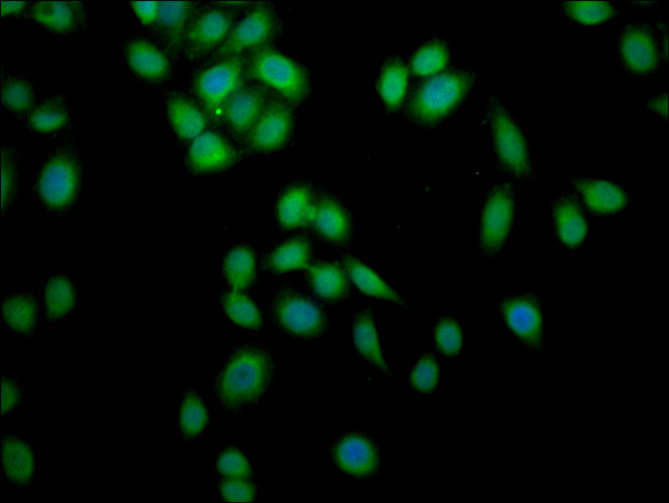 anti-Homo sapiens (Human) ZKSCAN3 Antibody raised in Rabbit