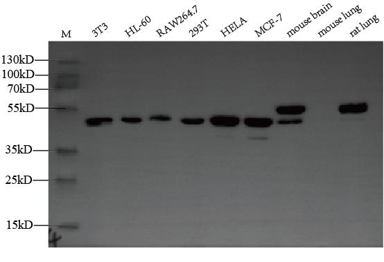 Western Blot Positive WB detected in: NIH/3T3 whole cell lysate, HL-60 whole cell lysate, RAW264.7 whole cell lysate All lanes: ZDHHC6 antibody at 1:2000 Secondary Goat polyclonal to rabbit IgG at 1/50000 dilution Predicted band size: 48 kDa Observed band size: 48 kDa Western Blot Positive WB detected in: NIH/3T3 whole cell lysate, HL-60 whole cell lysate, RAW264.7 whole cell lysate All lanes: ZDHHC6 antibody at 1:2000 Secondary Goat polyclonal to rabbit IgG at 1/50000 dilution Predicted band size: 48 kDa Observed band size: 48 kDa