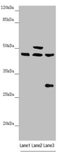 Western blot All lanes: HAUS8 antibody at 2.35 ug/ml Lane 1: Mouse kidney tissue Lane 2: Mouse brain tissue Lane 3: A549 whole cell lysate Secondary Goat polyclonal to rabbit IgG at 1/10000 dilution Predicted band size: 45, 39 kDa Observed band size: 45, 50, 28 kDa