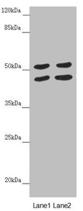 Western blot All lanes: HAUS8 antibody at 5.18 ug/ml Lane 1: Hela whole cell lysate Lane 2: A549 whole cell lysate Secondary Goat polyclonal to rabbit IgG at 1/10000 dilution Predicted band size: 45, 39 kDa Observed band size: 45, 52 kDa