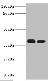 Western blot All lanes: Three-prime repair exonuclease 1 antibody at 3microg/ml Lane 1: Hela whole cell lysate Lane 2: HepG2 whole cell lysate Secondary Goat polyclonal to rabbit IgG at 1/10000 dilution Predicted band size: 39, 33, 34 kDa Observed band size: 39 kDa