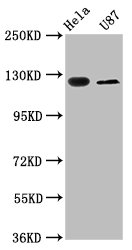 Western Blot Positive WB detected in: Hela whole cell lysate, U87 whole cell lysate All lanes: SLC4A5 antibody at 2.7ug/ml Secondary Goat polyclonal to rabbit IgG at 1/50000 dilution Predicted band size: 127, 125, 116, 109, 108, 114, 119 kDa Observed band size: 127 kDa