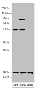 Western blot All lanes: UXT antibody at 3.2 ug/ml Lane 1: HL60 whole cell lysate Lane 2: 293T whole cell lysate Lane 3: Hela whole cell lysate Secondary Goat polyclonal to rabbit IgG at 1/10000 dilution Predicted band size: 18 kDa Observed band size: 18, 80, 55 kDa