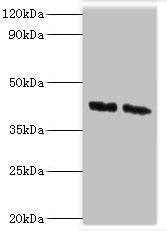 Western blot All lanes: COPS4 antibody at 8ug/ml Lane 1: Hela whole cell lysate Lane 2: HepG2 whole cell lysate Secondary Goat polyclonal to rabbit IgG at 1/10000 dilution Predicted band size: 47, 41 kDa Observed band size: 47 kDa Western blot All lanes: COPS4 antibody at 8ug/ml Lane 1: Hela whole cell lysate Lane 2: HepG2 whole cell lysate Secondary Goat polyclonal to rabbit IgG at 1/10000 dilution Predicted band size: 47, 41 kDa Observed band size: 47 kDa