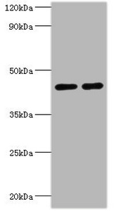 Western blot All lanes: NAD-dependent protein deacetylase sirtuin-3, mitochondrial antibody at 2ug/ml Lane 1: NIH/3T3 whole cell lysate Lane 2: HepG2 whole cell lysate Secondary Goat polyclonal to rabbit IgG at 1/10000 dilution Predicted band size: 44, 29 kDa Observed band size: 44 kDa Western blot All lanes: NAD-dependent protein deacetylase sirtuin-3, mitochondrial antibody at 2ug/ml Lane 1: NIH/3T3 whole cell lysate Lane 2: HepG2 whole cell lysate Secondary Goat polyclonal to rabbit IgG at 1/10000 dilution Predicted band size: 44, 29 kDa Observed band size: 44 kDa