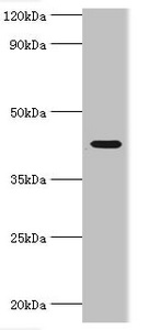 Western blot All lanes: NAD-dependent protein deacetylase sirtuin-3, mitochondrial antibody at 1ug/ml + HepG2 whole cell lysate Secondary Goat polyclonal to rabbit IgG at 1/10000 dilution Predicted band size: 44, 29 kDa Observed band size: 44 kDa Western blot All lanes: NAD-dependent protein deacetylase sirtuin-3, mitochondrial antibody at 1ug/ml + HepG2 whole cell lysate Secondary Goat polyclonal to rabbit IgG at 1/10000 dilution Predicted band size: 44, 29 kDa Observed band size: 44 kDa