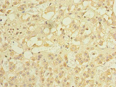 Immunohistochemistry of paraffin-embedded human adrenal gland tissue using CSB-PA882135LA01HU at dilution of 1: 100