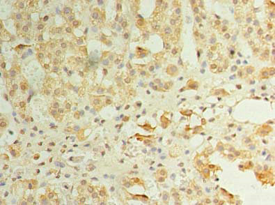 Immunohistochemistry of paraffin-embedded human adrenal gland tissue using CSB-PA882141LA01HU at dilution of 1: 100 Immunohistochemistry of paraffin-embedded human adrenal gland tissue using CSB-PA882141LA01HU at dilution of 1: 100
