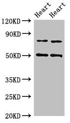 Western Blotting(WB) - Acss2 Antibody