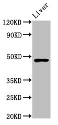 CSB-PA887159LA01HU