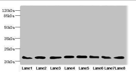 Western blot All lanes: RAB23 antibody at 3.88ug/ml Lane 1: Mouse ocular tissue Lane 2: Rat brain tissue Lane 3: Mouse kidney tissue Lane 4: Mouse lung tissue Lane 5: Mouse brain tissue Lane 6: NIH/3T3 whole cell lysate Lane 7: MCF-7 whole cell lysate Lane 8: Hela whole cell lysate Secondary Goat polyclonal to rabbit IgG at 1/10000 dilution Predicted band size: 27 kDa Observed band size: 27 kDa