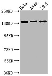 Western Blot Positive WB detected in: Hela whole cell lysate, A549 whole cell lysate, 293T whole cell lysate All lanes: MAN2B2 antibody at 1.4ug/ml Secondary Goat polyclonal to rabbit IgG at 1/50000 dilution Predicted band size: 114, 108 kDa Observed band size: 135 kDa