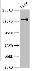 Western Blot Positive WB detected in: Rat kidney tissue All lanes: MAN2B2 antibody at 3.4ug/ml Secondary Goat polyclonal to rabbit IgG at 1/50000 dilution Predicted band size: 114, 108 kDa Observed band size: 114 kDa