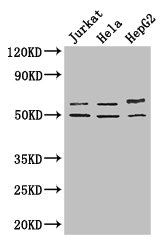 Western Blot Positive WB detected in: Jurkat whole cell lysate, Hela whole cell lysate, HepG2 whole cell lysate All lanes: YTHDF2 antibody at 2.7ug/ml Secondary Goat polyclonal to rabbit IgG at 1/50000 dilution Predicted band size: 63, 57 kDa Observed band size: 63, 50 kDa Western Blot Positive WB detected in: Jurkat whole cell lysate, Hela whole cell lysate, HepG2 whole cell lysate All lanes: YTHDF2 antibody at 2.7ug/ml Secondary Goat polyclonal to rabbit IgG at 1/50000 dilution Predicted band size: 63, 57 kDa Observed band size: 63, 50 kDa