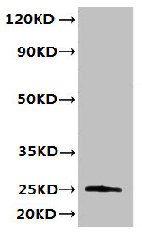 Western blot All lanes: TMED3 antibody at 6ug/ml + MCF-7 whole cell lysate Secondary Goat polyclonal to rabbit IgG at 1/10000 dilution Predicted band size: 25, 20 kDa Observed band size: 25 kDa