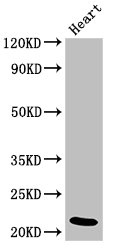 Western Blot Positive WB detected in: Rat heart tissue All lanes: NDUFB9 antibody at 4ug/ml Secondary Goat polyclonal to rabbit IgG at 1/50000 dilution Predicted band size: 22 kDa Observed band size: 22 kDa