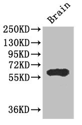 Western Blot Positive WB detected in: Mouse brain tissue All lanes: ICE1 antibody at 2.7ug/ml Secondary Goat polyclonal to rabbit IgG at 1/50000 dilution Predicted band size: 68 kDa Observed band size: 68 kDa Western Blot Positive WB detected in: Mouse brain tissue All lanes: ICE1 antibody at 2.7ug/ml Secondary Goat polyclonal to rabbit IgG at 1/50000 dilution Predicted band size: 68 kDa Observed band size: 68 kDa