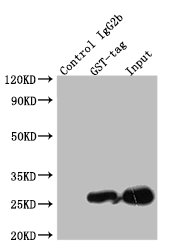 Immunoprecipitating GST in transfected-293F whole cell lysate Lane 1: Mouse control IgG instead of CSB-MA000031M1m in 293F cell lysate Transfected with GST Lane 2: CSB-MA000031M1m (5g) + Transfected-293F whole cell lysate (500g) Lane 3: Transfected-293F whole cell lysate (10g) For western blotting, the blot was detected with CSB-MA000031M1m at 1:2000, and a HRP-conjugated Protein G antibody was used as the secondary antibody at 1:50000
